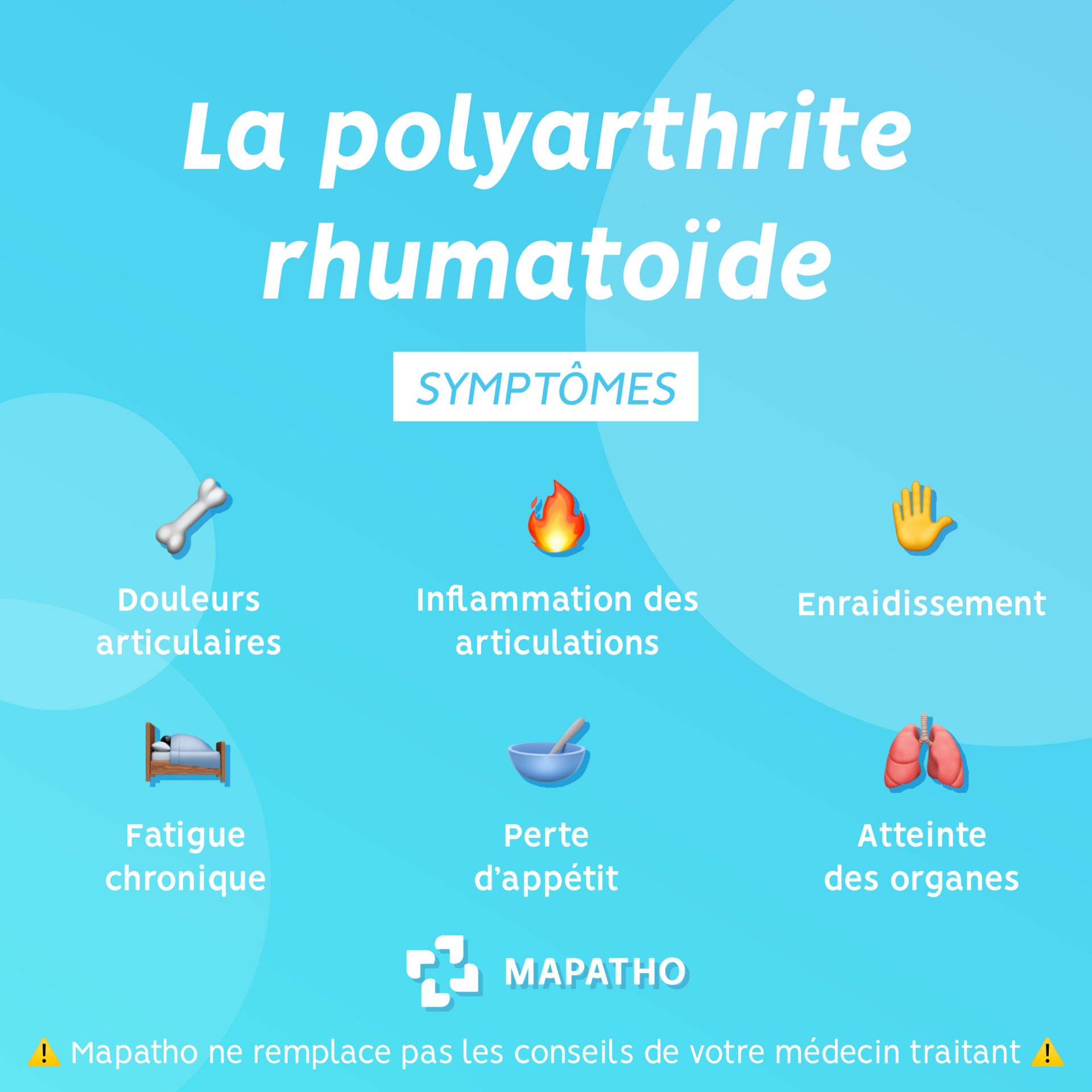 Iconographie des symptomes de la polyarthrite rhumatoide